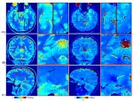In vivo meso-scale whole-brain quantitative imaging with tailored MRF on the NexGen 7T scanner