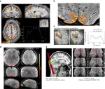 Next-generation MRI scanner designed for ultra-high-resolution human brain imaging at 7 Tesla