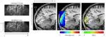 Pushing the limits of ultra-high resolution human brain imaging with SMS-EPI demonstrated for columnar level fMRI